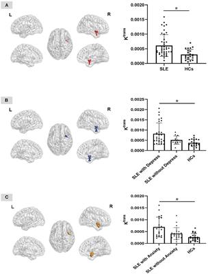 Increasing of Blood Brain Barrier Permeability and the Association With Depression and Anxiety in Systemic Lupus Erythematosus Patients